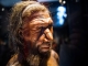 Neandertaler-Chirurgie: Amputationen und soziale Fürsorge